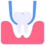 tooth-extraction